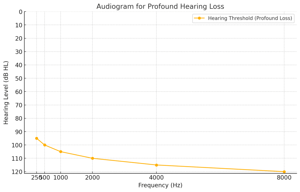 profound Hearing loss